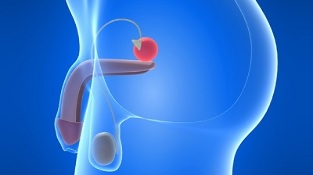 masáž prostaty pro prevenci prostatitidy